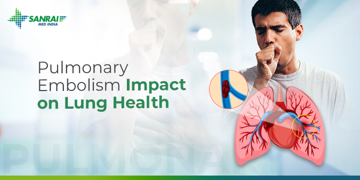 Pulmonary Embolism Impact on Lung Health